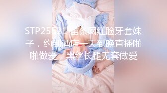 STP25521 苗条网红脸牙套妹子，约到酒店一天到晚直播啪啪做爱，黑丝长腿无套做爱